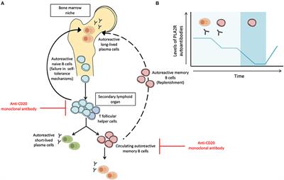 Immune-Monitoring Disease Activity in Primary Membranous Nephropathy